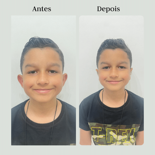 Antes
