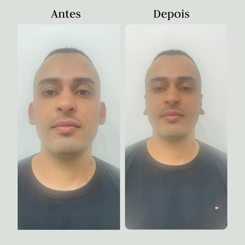 Antes (4)
