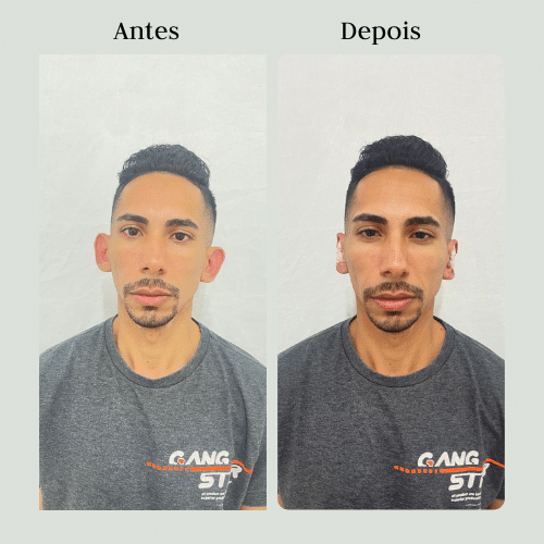 Antes (2)